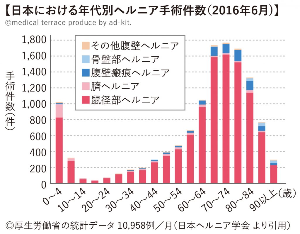 年代別ヘルニア手術件数